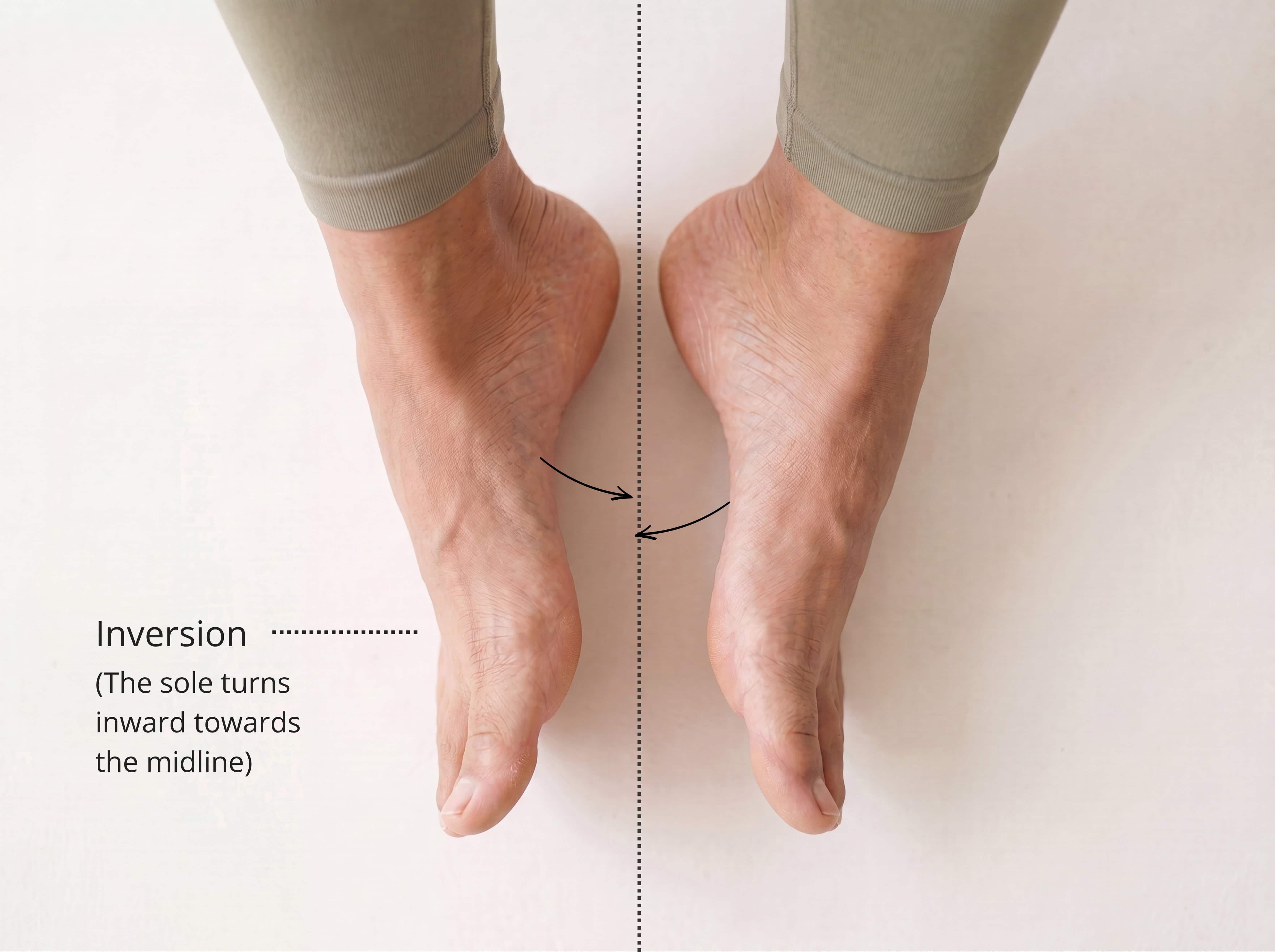 Inversion — the sole of the foot turns inward toward the midline